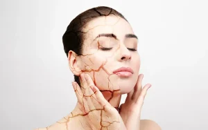 Dry vs. Dehydrated Skin