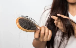 Top Causes of Hair Loss
