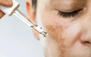 Ingredients to Fade Dark Spots & Hyperpigmentation